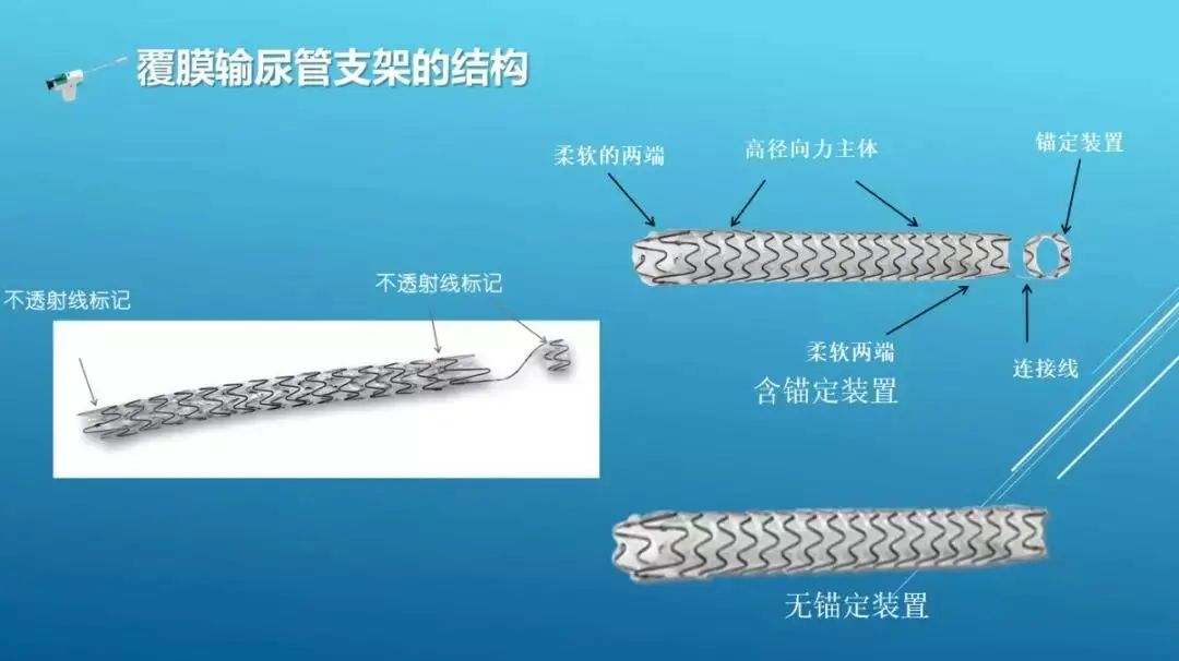 前列腺癌、膀胱癌、肾癌等手术做的怎么样(图3) 泌尿科_科泌尿外科_甘肃省人民医院泌尿2科
