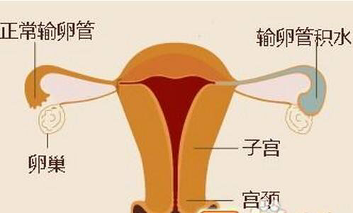 育不孕医院哪家好_郑州不育不孕_不孕不育